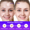 180pcs/set Face Skin Care Acne Pimple Patch